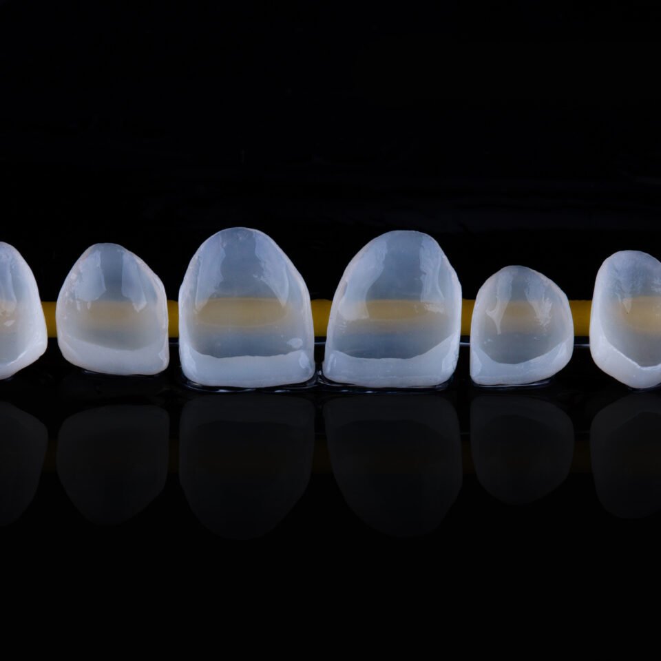 Material usado nas lentes de contato dental: conheça a diferença de cada um deles
