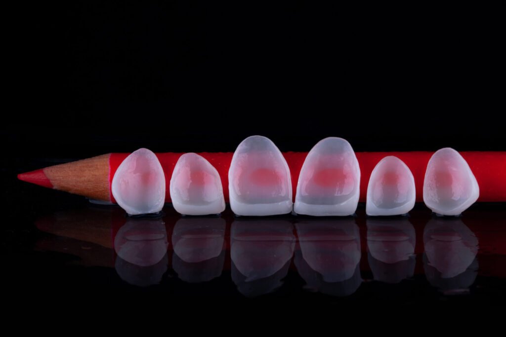 Lente de Contato Dental 