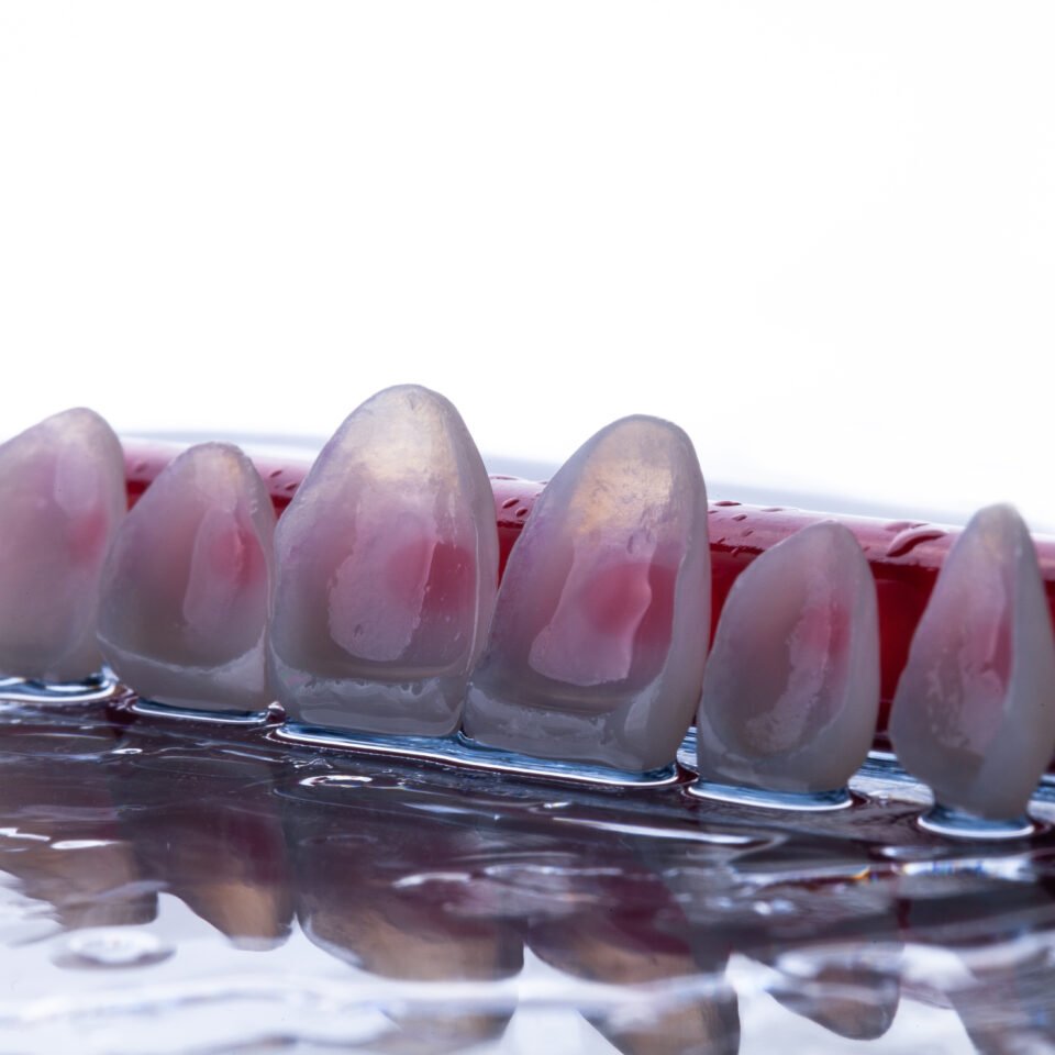 Passo a Passo Lente de Contato Dental