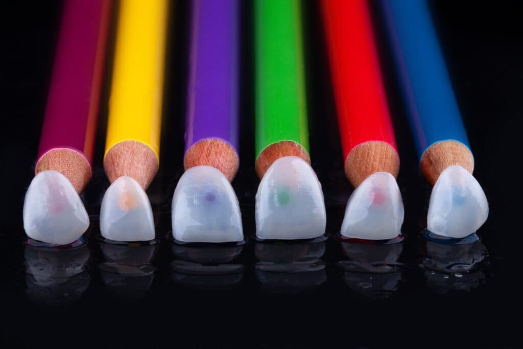 tipo de lente dental