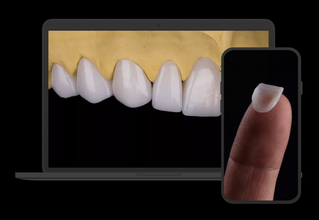 lente de contato dental no dedo