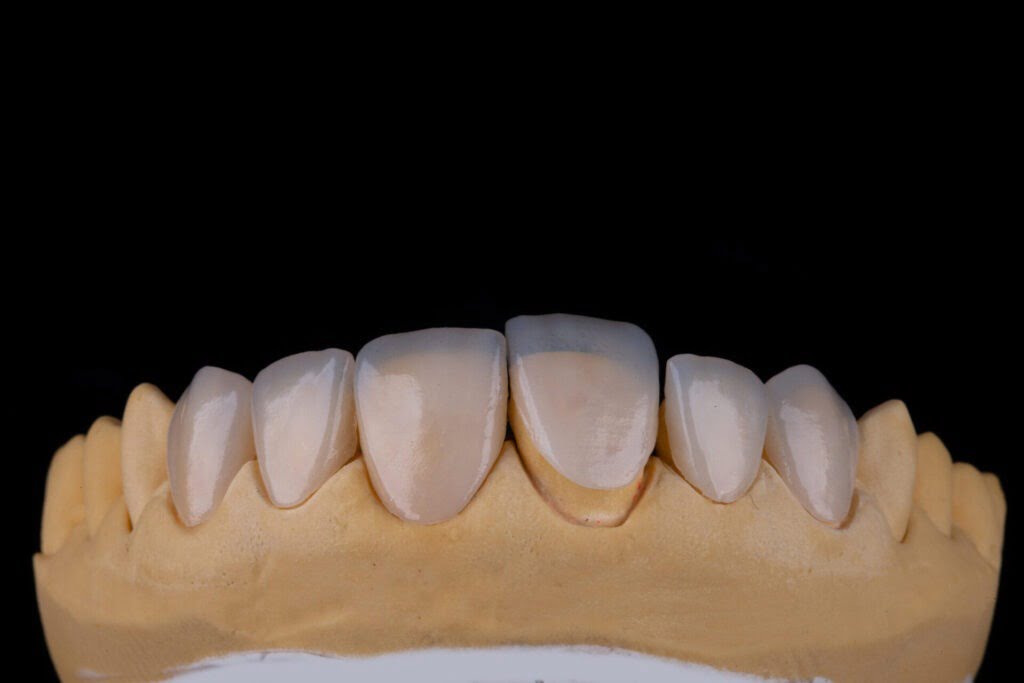 lentes-de-contato-ultra-finas