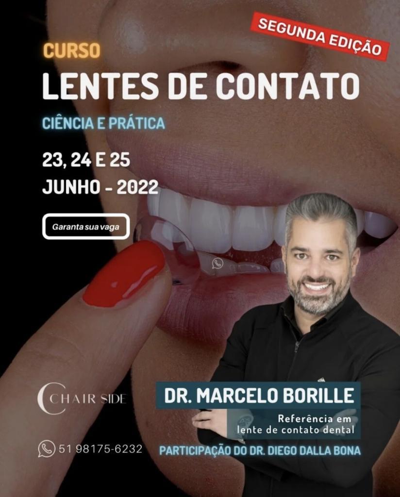 segunda edição do curso de lentes de contato dentais