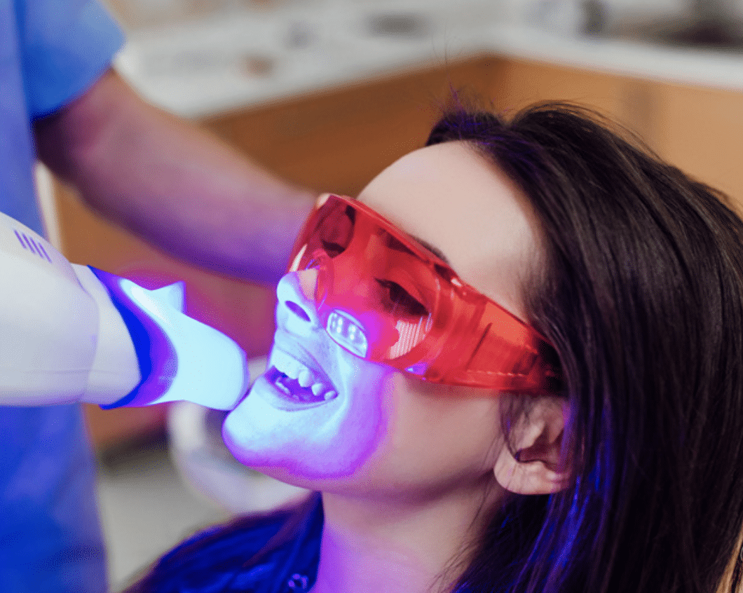 clareamento dental a laser